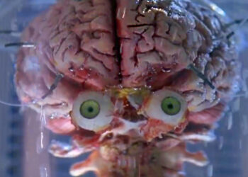 Риск рассеянного склероза при инфицировании вирусом Эпштейна – Барра