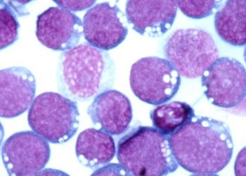 Как вирус Эпштейна-Барра может повлиять на рассеянный склероз?