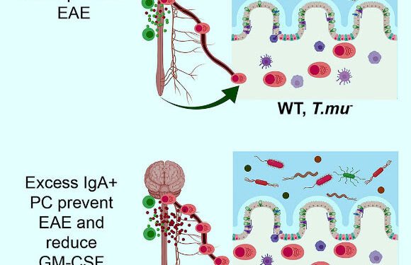 Исследование также поднимает вопросы о микробиоме и образе жизни людей с рассеянным склерозом 1 Исследование также поднимает вопросы о микробиоме и образе жизни людей с рассеянным склерозом