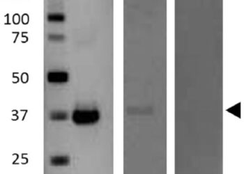Доказательства наличия эпсилон-токсина Clostridium perfringens, связанного с рассеянным склерозом