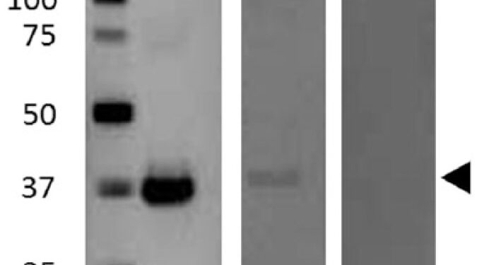 Доказательства наличия эпсилон-токсина Clostridium perfringens, связанного с рассеянным склерозом 1 Доказательства наличия эпсилон-токсина Clostridium perfringens, связанного с рассеянным склерозом