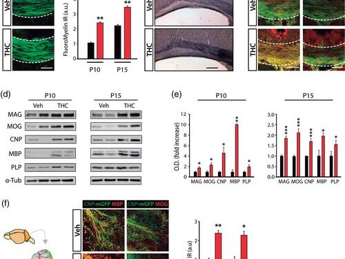 Тетрагидроканнабинол способствует развитию олигодендроцитов и миелинизации ЦНС 1 Тетрагидроканнабинол способствует развитию олигодендроцитов и миелинизации ЦНС