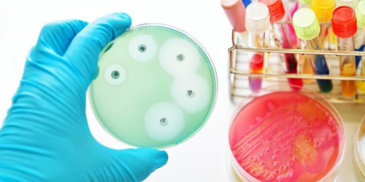 Бактериальный эпсилон токсин, обнаруженный у пациентов с РС, вызывает признаки заболевания РС у грызунов