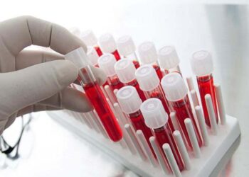 Повышенный уровень NfL в сыворотке может указывать на хронические активные поражения