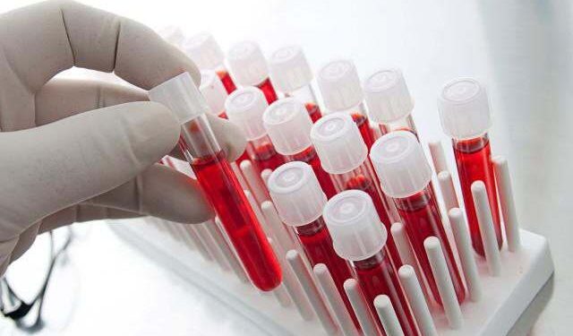 Повышенный уровень NfL в сыворотке может указывать на хронические активные поражения 1 Повышенный уровень NfL в сыворотке может указывать на хронические активные поражения