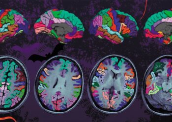 Одновременное разрушение аксона и миелина отличает Х-сцепленную адренолейкодистрофию от рассеянного склероза