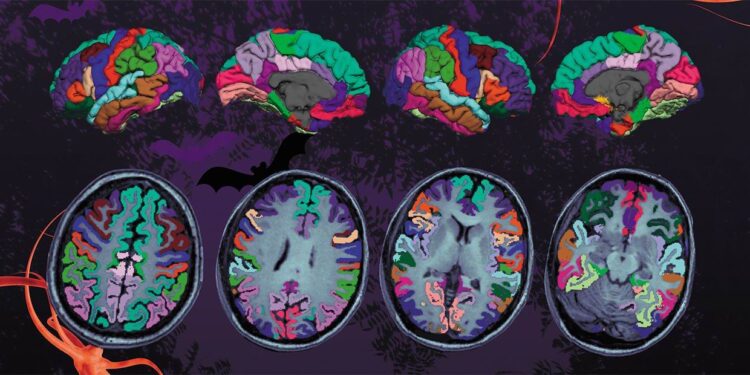 Одновременное разрушение аксона и миелина отличает Х-сцепленную адренолейкодистрофию от рассеянного склероза 1 Одновременное разрушение аксона и миелина отличает Х-сцепленную адренолейкодистрофию от рассеянного склероза