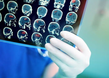 Сигнальный белок помогает продвигать клетки, производящие миелин