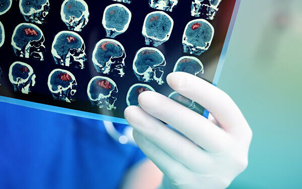 Сигнальный белок помогает продвигать клетки, производящие миелин 1 Сигнальный белок помогает продвигать клетки, производящие миелин