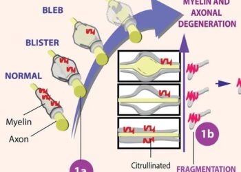 Парадигмы «снаружи внутрь» и «наизнанку» у пациентов с рассеянным склерозом