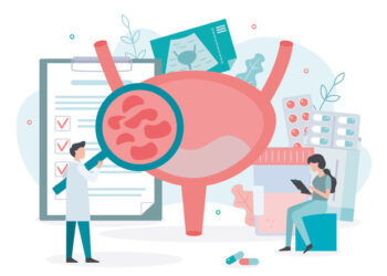 Открытое пилотное исследование экстрактов на основе каннабиса для лечения дисфункции мочевого пузыря при запущенном рассеянном склерозе