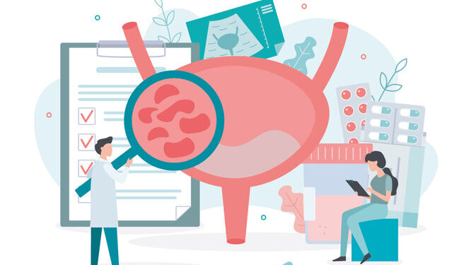 Открытое пилотное исследование экстрактов на основе каннабиса для лечения дисфункции мочевого пузыря при запущенном рассеянном склерозе