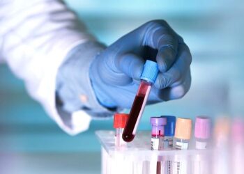 Уровень плейотропина в сыворотке повышен при ремиттирующем рассеянном склерозе и коррелирует с полом, ИМТ и лечением.