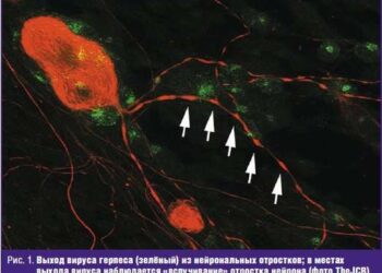 Герпесвирусы и скрытые связи с невропатологией рассеянного склероза