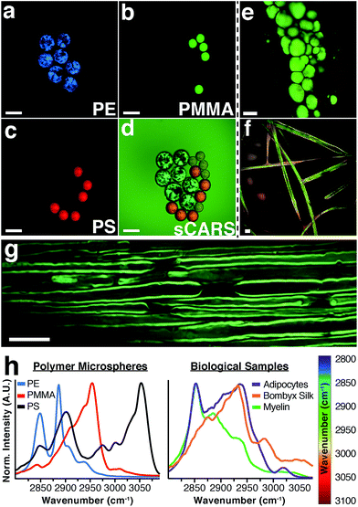 Биохимические изменения липидов, обнаруженные в нормальном внешнем белом веществе хронического рассеянного склероза с помощью спектральной когерентной рамановской визуализации