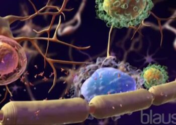 Рассеянный склероз связан с инфекцией в подростковом возрасте — новое исследование