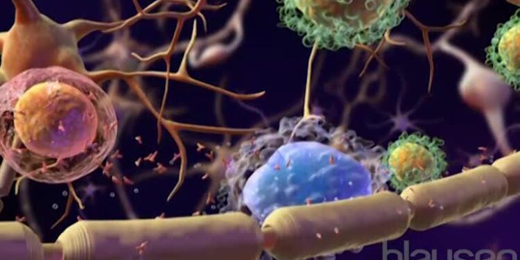 Рассеянный склероз связан с инфекцией в подростковом возрасте - новое исследование 1 Рассеянный склероз связан с инфекцией в подростковом возрасте — новое исследование