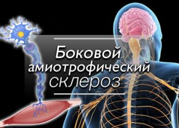 Исследования SLS-005 фазы II/III при боковом амиотрофическом склерозе