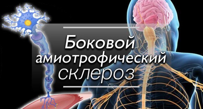 Исследования SLS-005 фазы II/III при боковом амиотрофическом склерозе