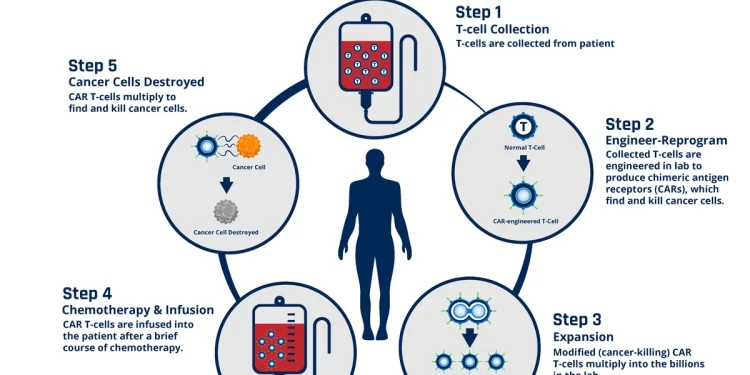 У 3 пациентов с прогрессирующим рассеянным склерозом наблюдается снижение степени инвалидности после CAR-Т-клеточной терапии 1 У 3 пациентов с прогрессирующим рассеянным склерозом наблюдается снижение степени инвалидности после CAR-Т-клеточной терапии